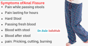 Symptoms of Anal Fissure